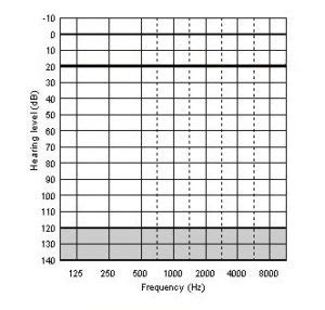 How to Read Your Hearing Test Results: The Audiogram