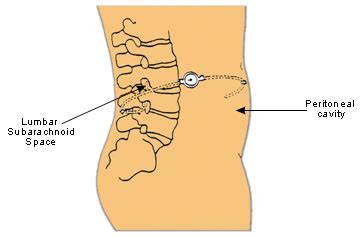 You down with PTC?: Surgery and Other Things