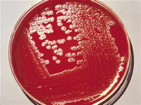 Colonies of Bacillus anthracis on sheep blood agar plate. Courtesy of ...