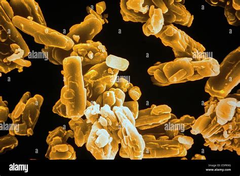 Cholesterol crystals at SEM (Scanning Electron Microscope Stock Photo ...