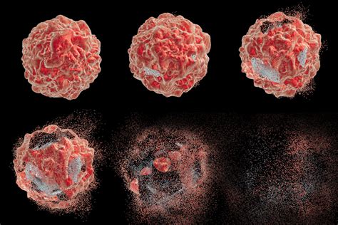 Trending With Impact: ONC201 Induces Apoptosis in Breast Cancer ...