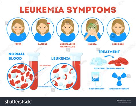 Leukemia Symptom: Over 701 Royalty-Free Licensable Stock Illustrations ...