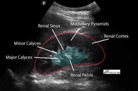 Normal Kidney Ultrasound