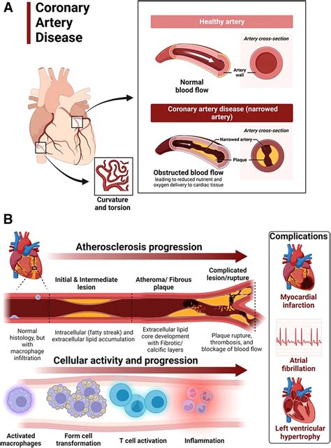 Frontiers | Hypertensive heart disease: risk factors, complications and ...