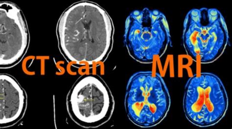 CT Scan and MRI result [2] | Download Scientific Diagram