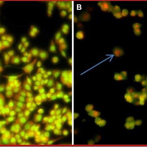 Stains the acridine orange/ethidium bromide staining in control (A) and ...