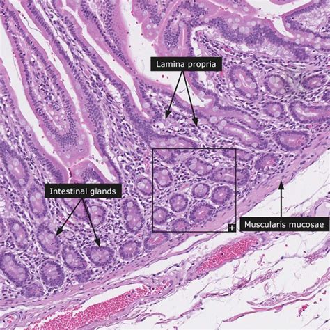 Histology - Small intestine Tissue Biology, Cell Biology, Science ...