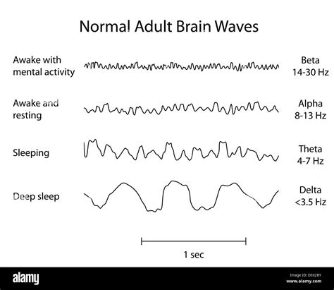 Sleep Stages Eeg Waves