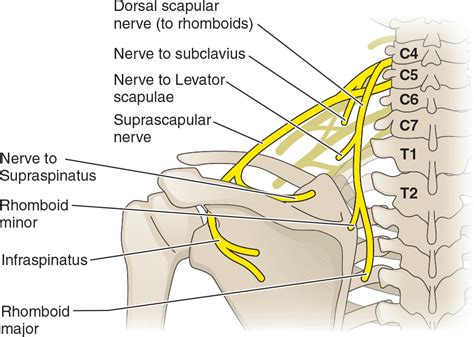 Shoulder Injuries From Trauma – Scapula Nonunion | HOPE TBI