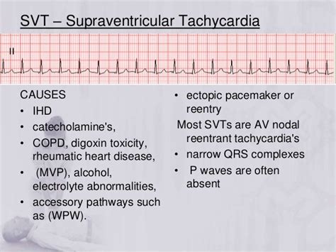 acls