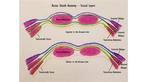 [Figure, Rectus Sheath Anatomy, superior and...] - StatPearls - NCBI ...