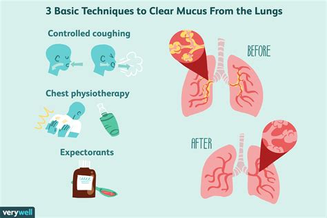 How to Treat Increased Mucus in the Lungs