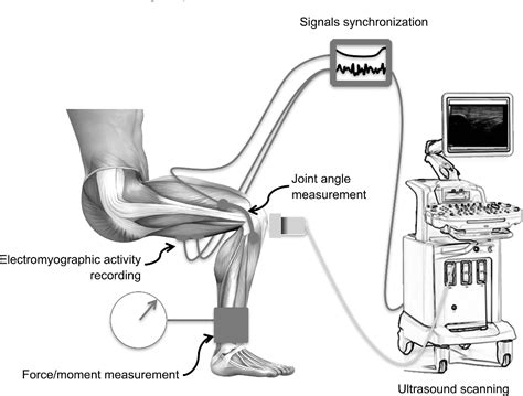 Figure 1 from Ultrasound-based testing of tendon mechanical properties ...