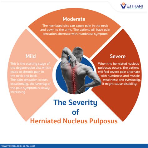 The Severity of Herniated Nucleus Pulposus