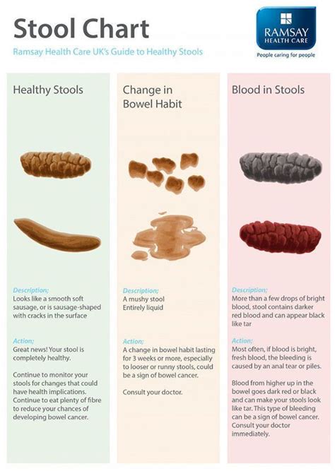 Bowel cancer symptoms: Signs of a tumour include red blood in poo ...