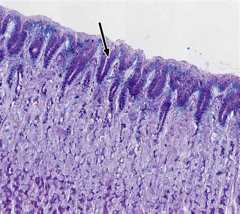 Pharynx, Esophagus, and Stomach | histology