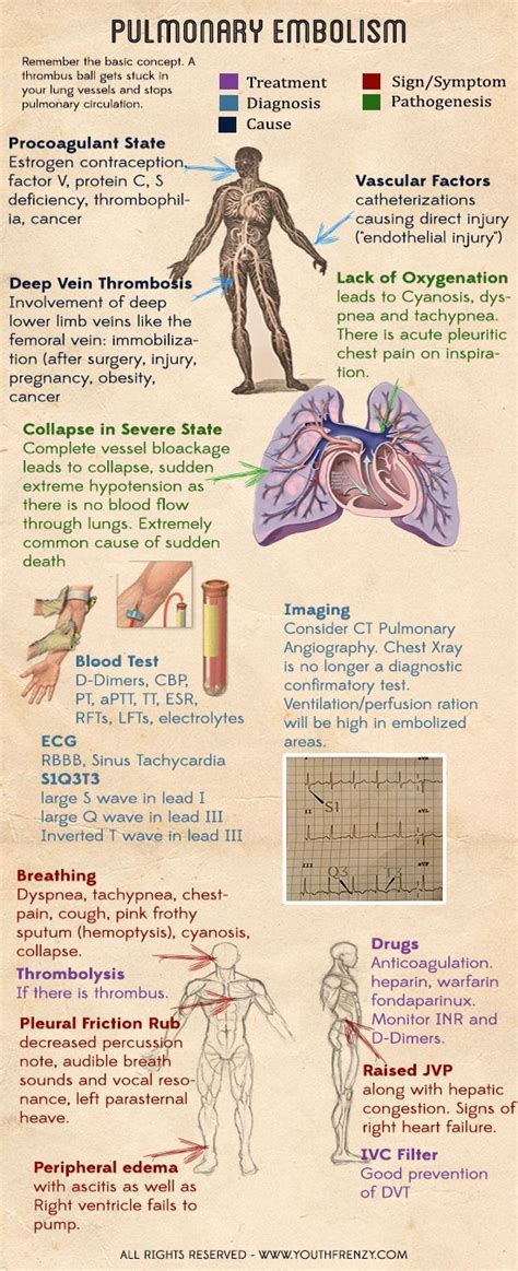 Pulmonary Embolism System Disorder Template