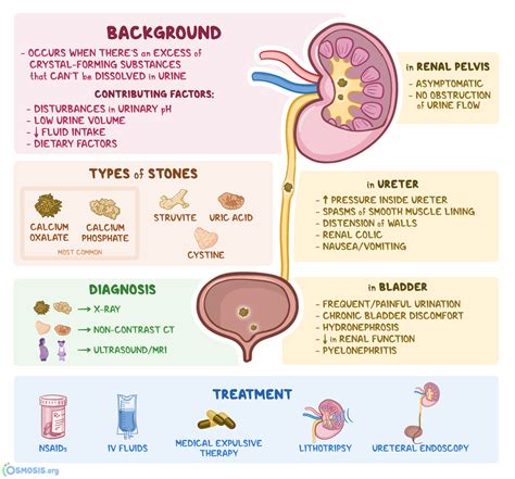 Renal Calculi Icd 10 - ManuelqoHogan