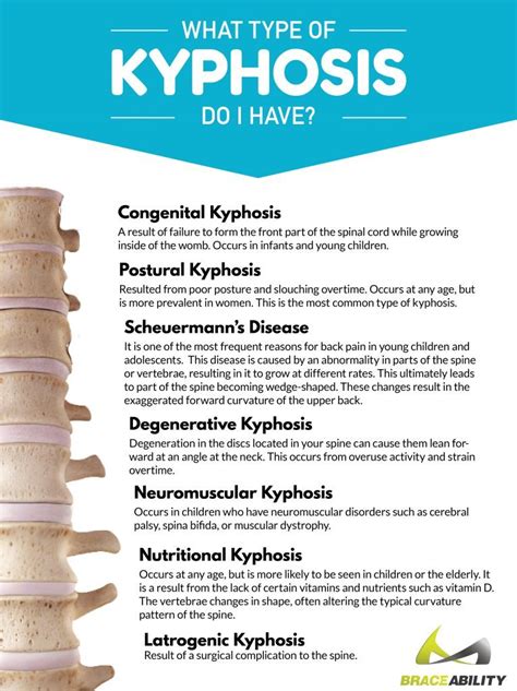 Kyphosis: Different Types & Treatment Options