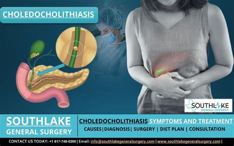 Choledocholithiasis – Symptoms and Treatment, Southlake