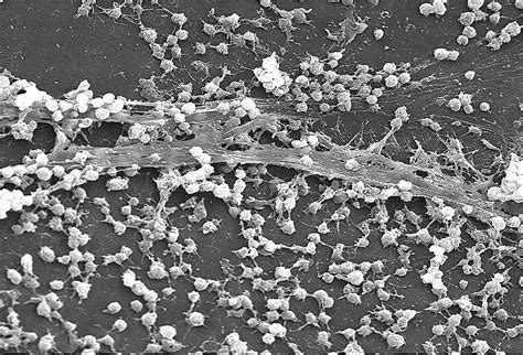 Free picture: biofilm, formation, lumen, indwelling, catheter, secreted ...