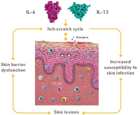 DUPIXENT® (dupilumab) Mechanism of Action for Uncontrolled Moderate-to ...