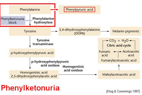 Phenylketonuria