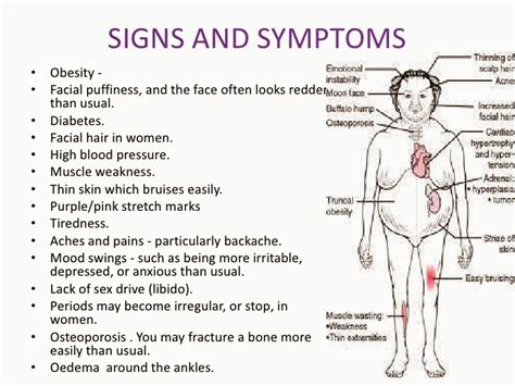 Signs and symptoms of adrenal cancers | Healthy Family