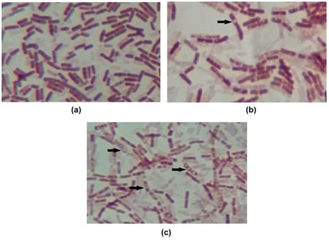 Images of endospore staining of (a) control, (b) OR + RL MIC 14h and ...