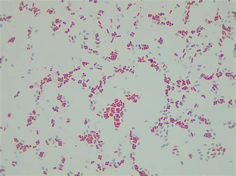 Micrograph Bacillus subtilis 48h endospore 1000X p000063 | OER Commons