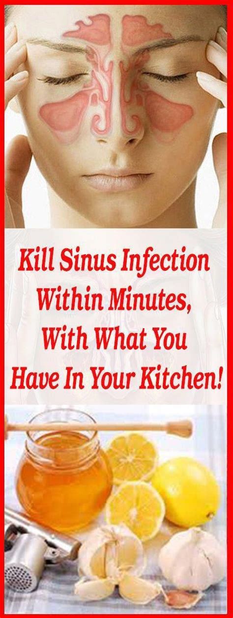 One Of The Best Home Remedy For Sinus Infection #MEDICAL-HEALTH-DIET ...