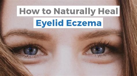 Homemade Eye Cream For Eczema - Homemade Ftempo