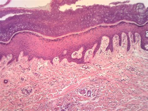 Stratified Squamous Epithelium Location