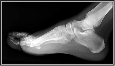 SWSLHD - Medical Imaging - Bone X-ray