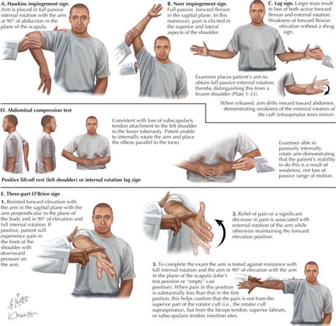 Shoulder Impingement Physical Exam