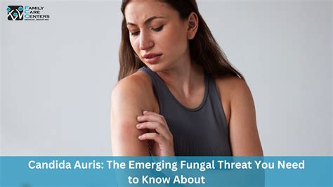 Candida Auris: The Emerging Fungal Threat You Need to Know About