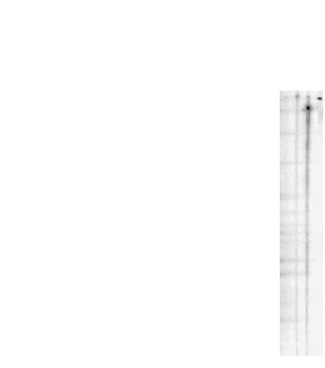 Downstream cistron expression is not due to enhanced ribosomal ...