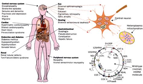 Mitochondrial DNA and disease - The Lancet