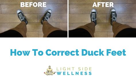 How To Fix Duck Feet And Walk Properly Your Body Posture | vlr.eng.br