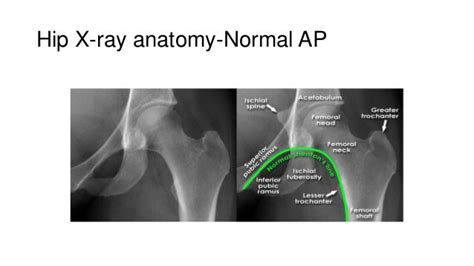 Upper Limb