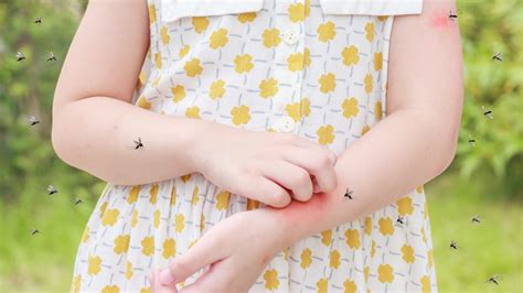 7 tips to prevent mosquito bites in children | HealthShots