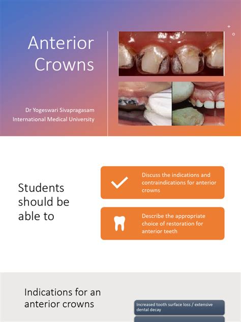 Anterior Crowns | PDF