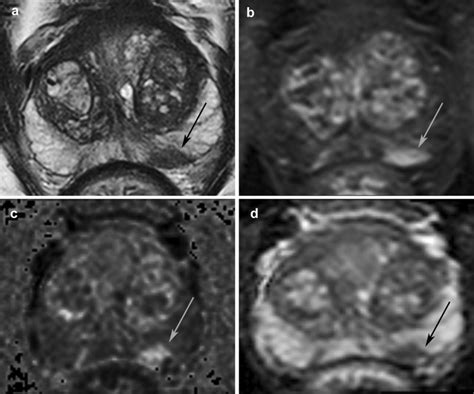 Representative MRI images used in our MRI-directed diagnostic pathway ...