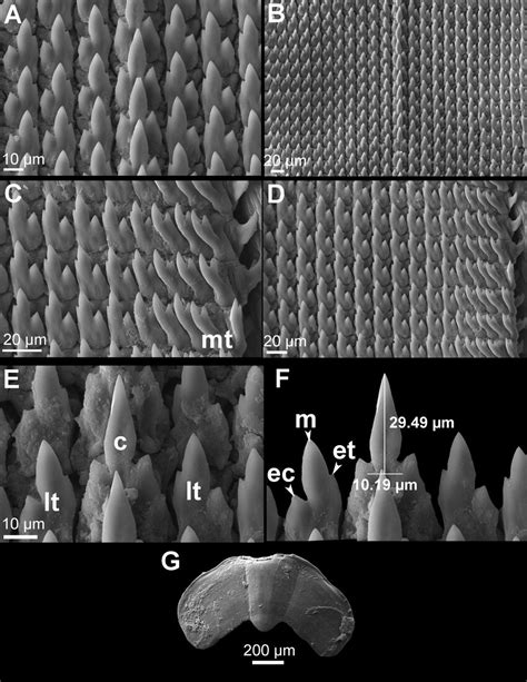 Scanning electron microscope images of the radula and jaw of ...