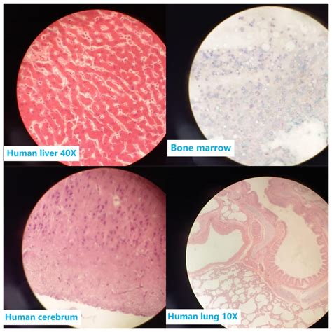 Prepared Human Tissue Anatomy Microscope Slides Set, 17pcs Hand ...