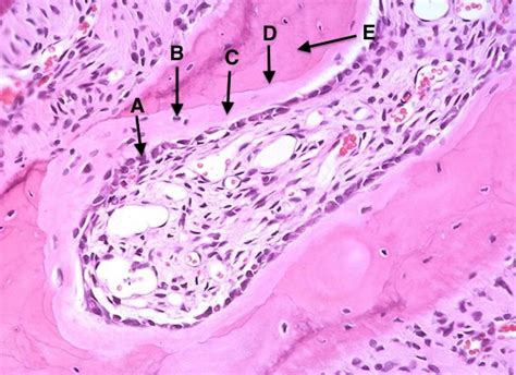 Answer: A = osteoblasts, B = osteocytes, C = osteoid, D = cement line E ...