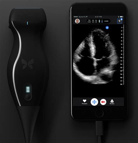 Butterfly IQ gets FDA clearance for chip-based, smartphone-connected ...