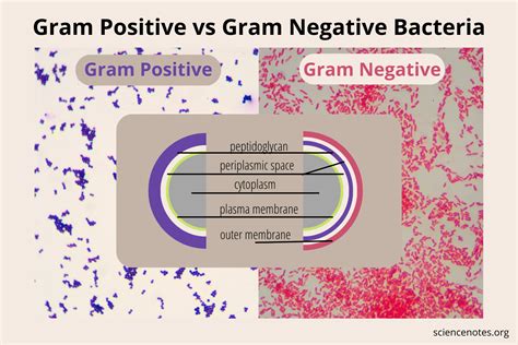 Gram Positive vs Gram Negative Bacteria