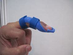 NEW Oval 8 Finger Splint Size 7, Wear 6 Ways Stabilizes Arthritis ...