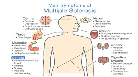 symptoms of multiple sclerosis | Patient Talk